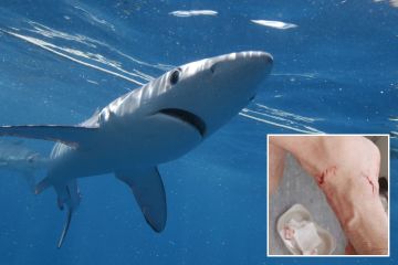Hai zerfleischt das Bein eines Schwimmers an britischem Urlaubs-Hotspot, als drei Strände geschlossen wurden