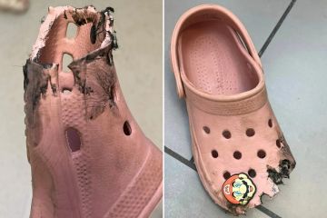Mutter warnt nach „ungewöhnlichem Unfall“ ihrer Tochter davor, Crocs auf Rolltreppen zu tragen