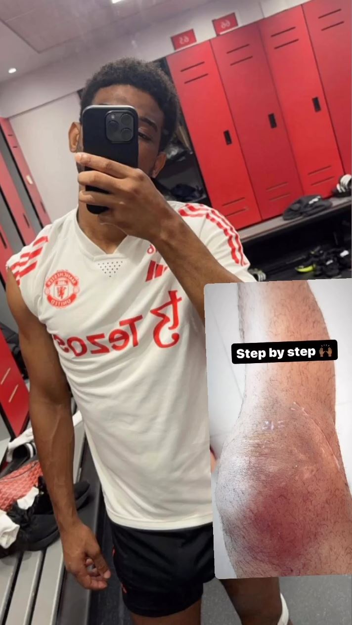 Amad schlug in den sozialen Medien vor, dass er sich einer Knieoperation unterzogen habe
