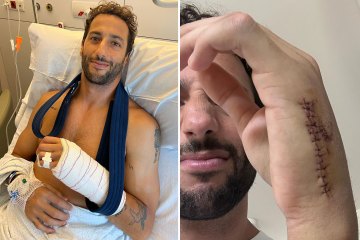 F1-Star Daniel Ricciardo zeigt nach einer Operation an einer gebrochenen Hand eine grausige Narbe