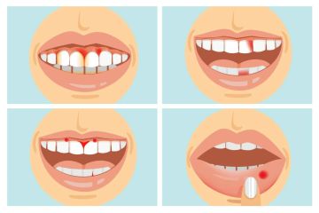 Die 7 Dinge, die Ihre Zähne Ihnen über Ihre Gesundheit und den Zeitpunkt der Panik verraten können