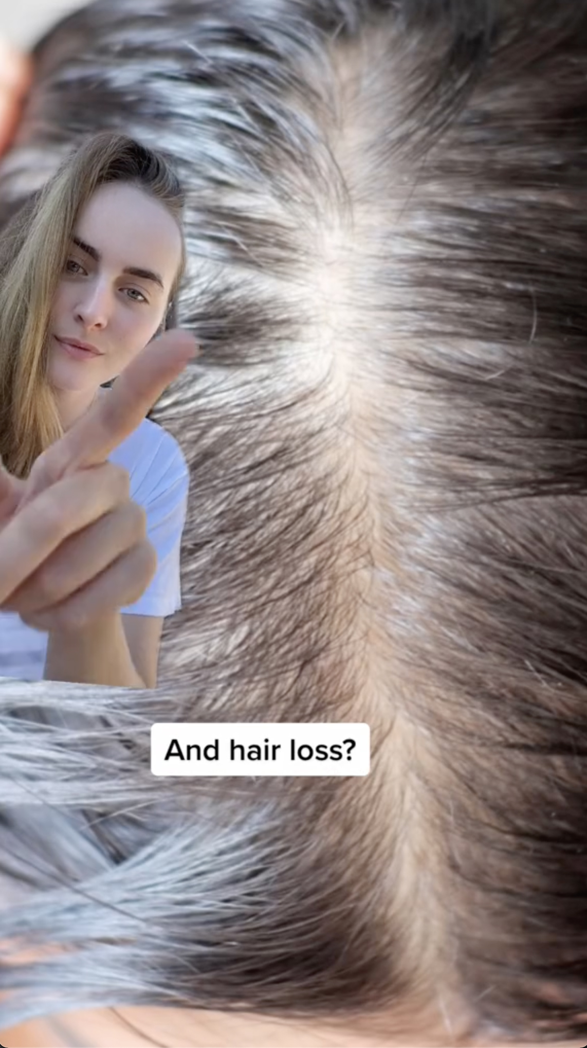 Caroline ermutigte Menschen, die unter dünner werdendem Haar und Haarausfall leiden, ihre Lösung auszuprobieren