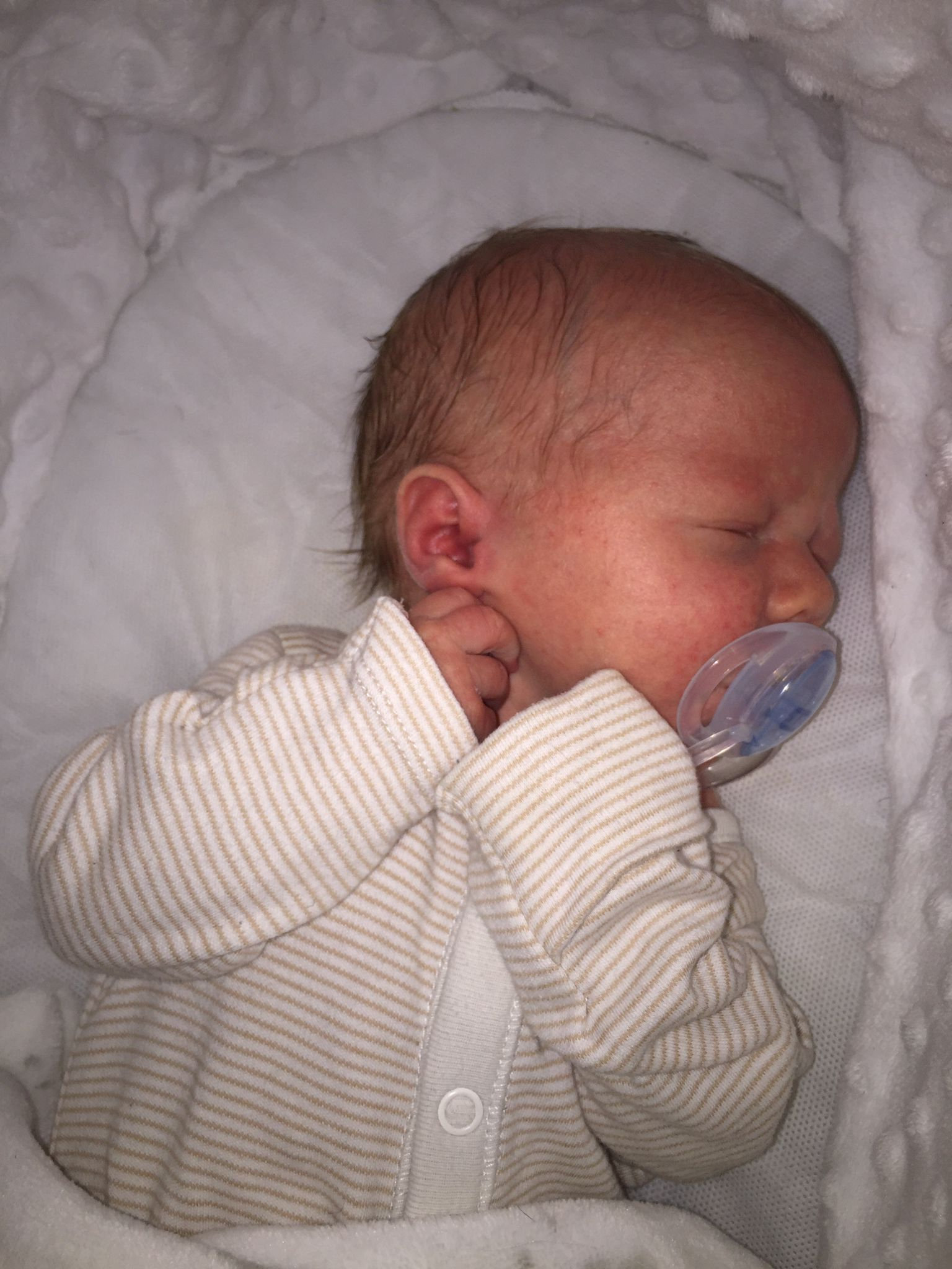 Das vier Wochen alte Baby Riley hat in der befallenen Sozialwohnung von Hammersmith und Fulham an Bettwanzenbissen gelitten