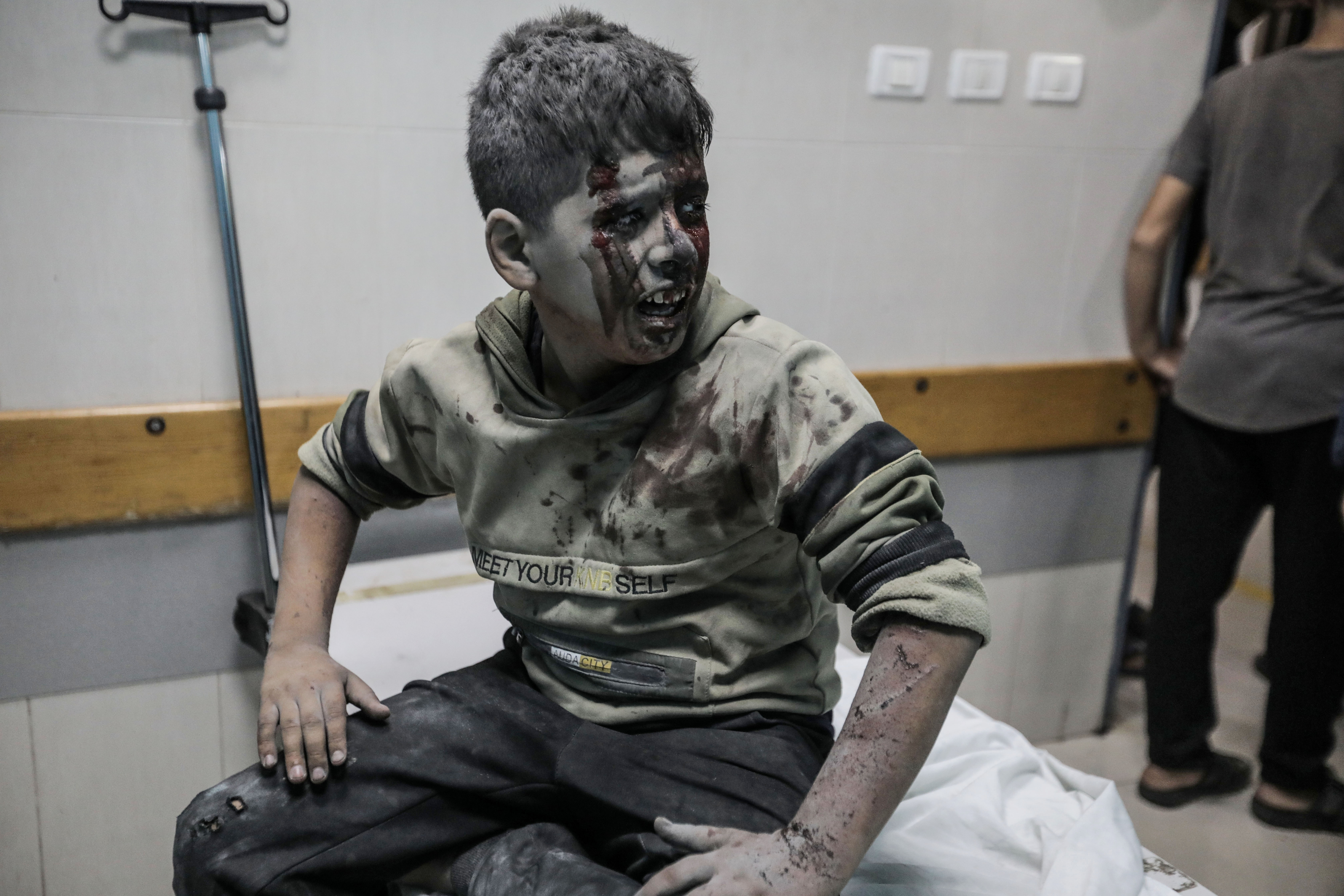 Ein durch israelische Razzien verletzter Junge wird in einem Krankenhaus in Gaza behandelt