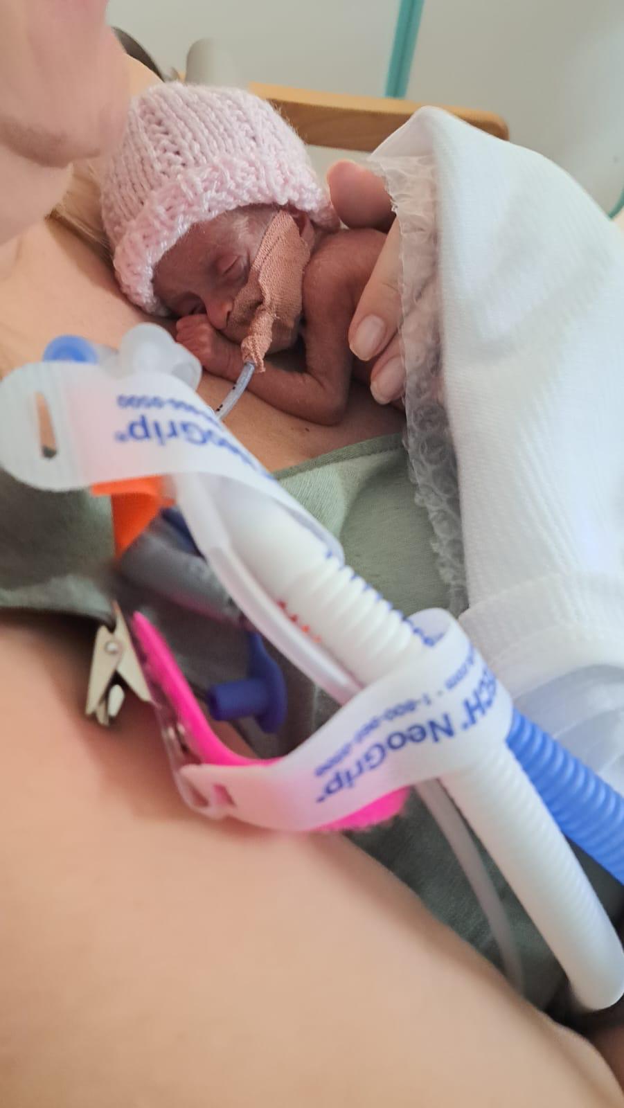Das Baby hatte in der ersten Woche nach der Geburt Probleme mit seinem Stuhlgang und dem Trinken seiner Milch