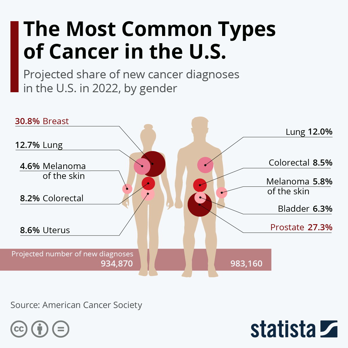 Infografik: Die häufigsten Krebsarten in den USA |  Statista