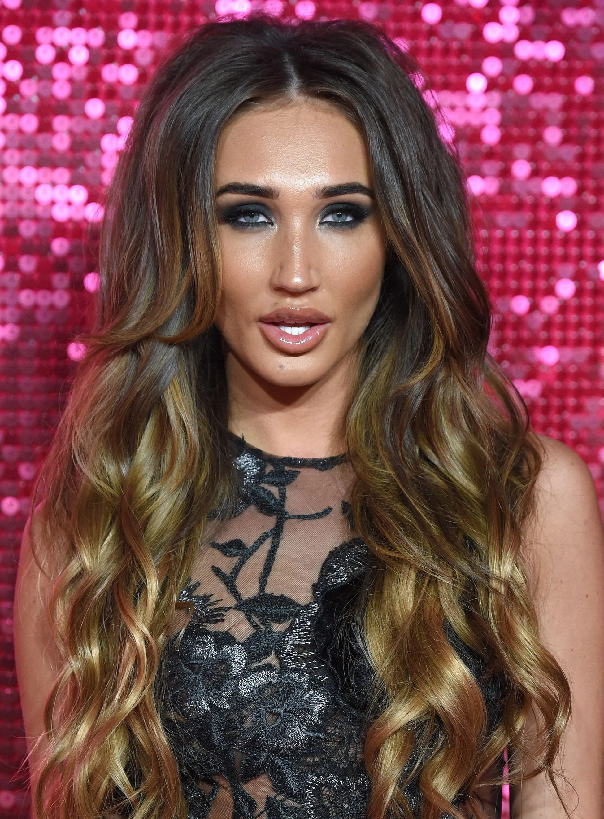 Megan McKenna was known for her love of lip fillers in the early days of her career