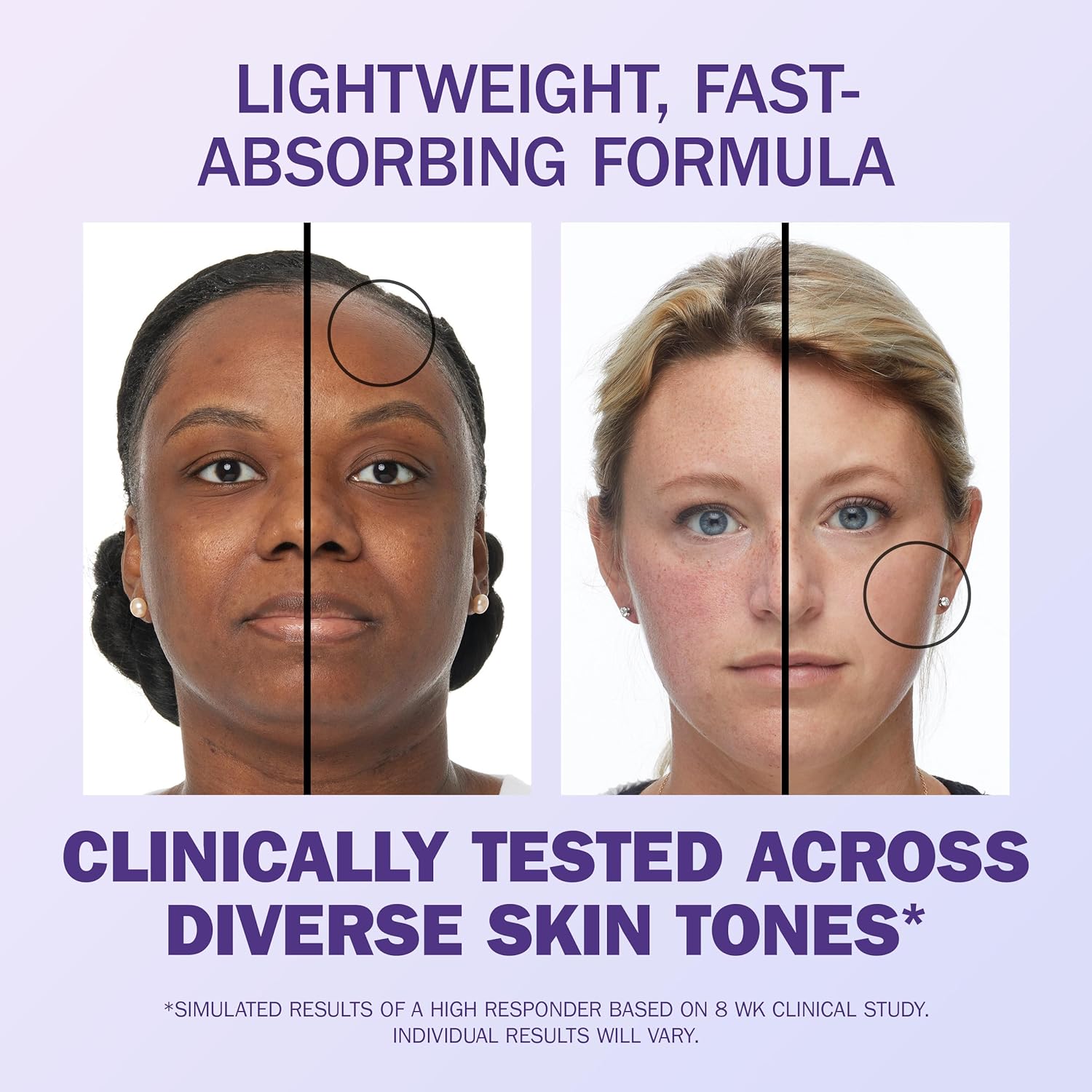 Es besteht aus fünf „starken Inhaltsstoffen“, die nachweislich für alle Hauttöne Ergebnisse liefern