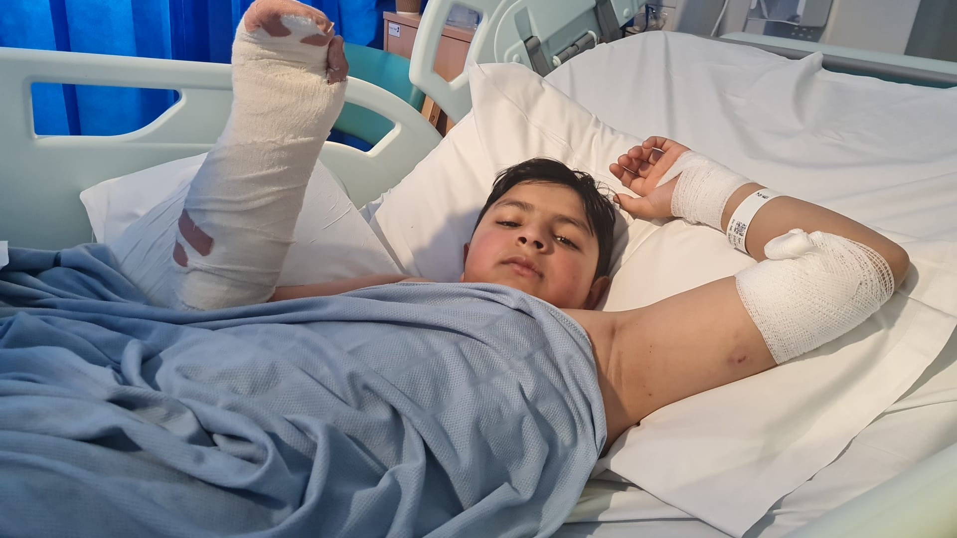 Mohid Gardazee, 12, wurde ins Krankenhaus gebracht, nachdem er letztes Jahr in Oldham von einem der Hunde misshandelt worden war