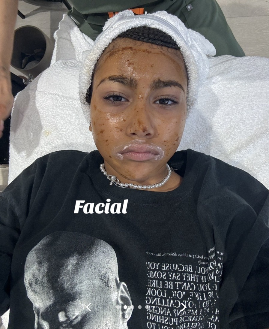 North postet oft über ihre umfangreichen Hautpflegebemühungen, einschließlich professioneller Gesichtsbehandlungen