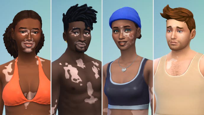 Vitiligo-Beispiele in Die Sims 4 (Gesicht)