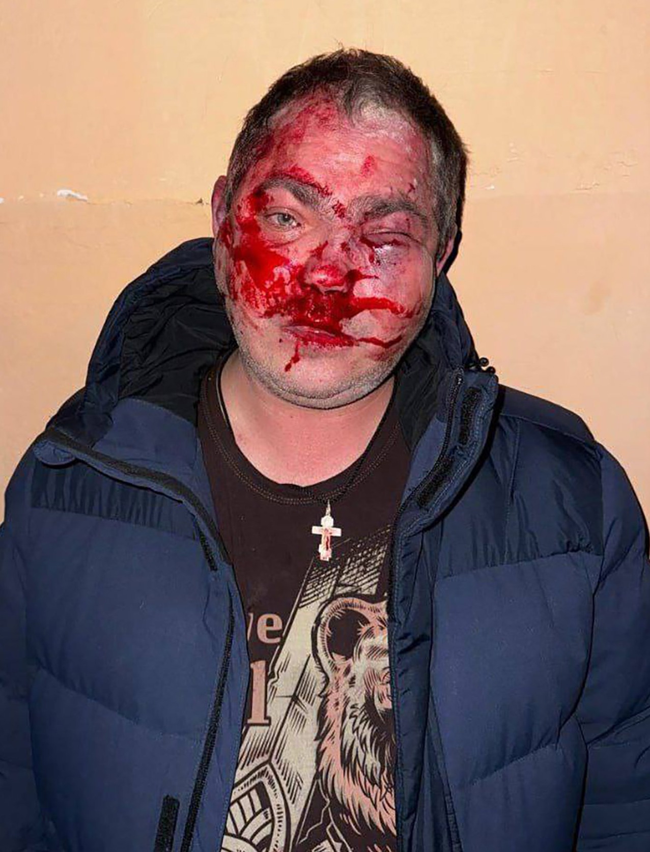 Ein Mann hatte ein blutiges, entstelltes Gesicht