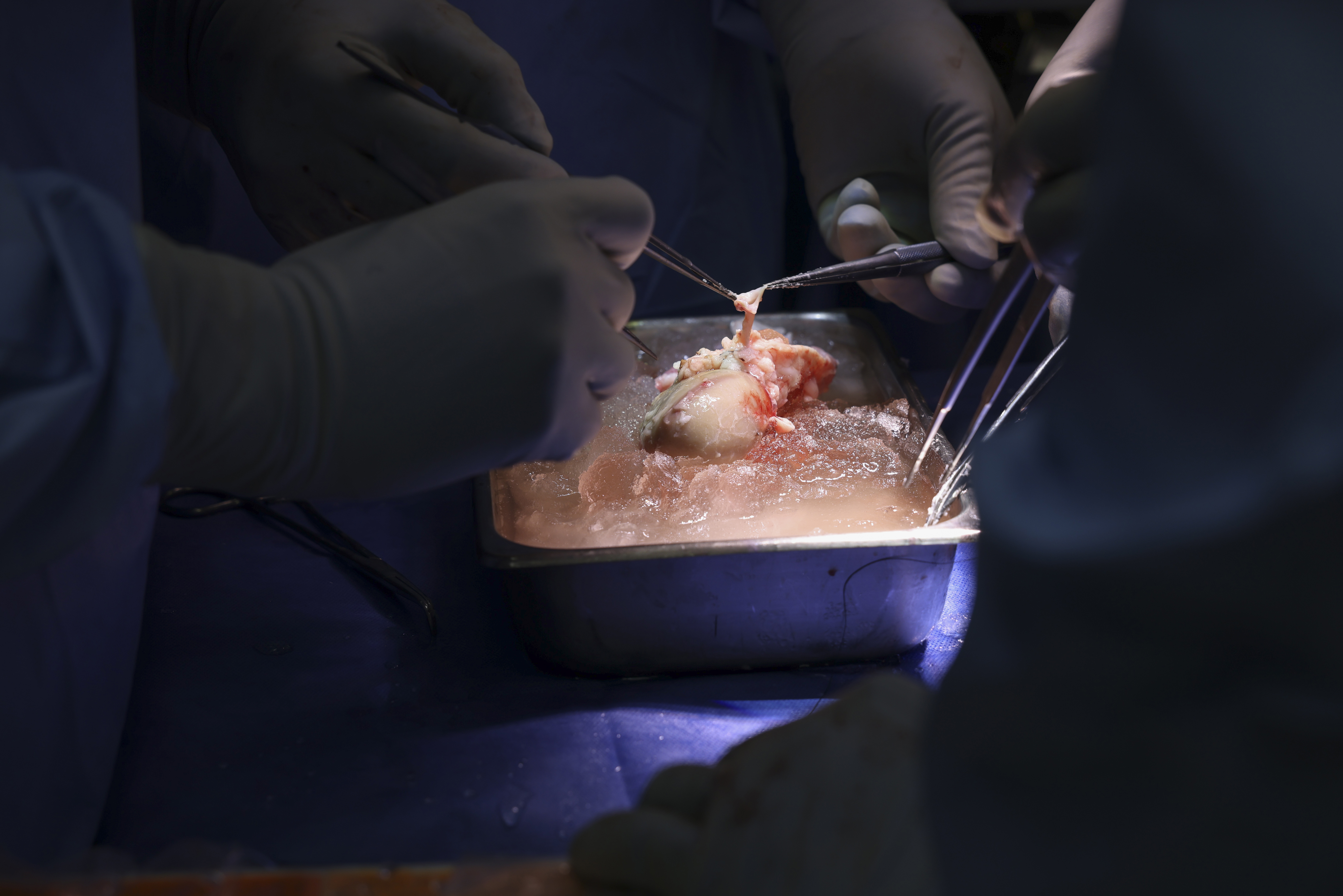Chirurgen bereiten die Schweineniere für die Transplantation vor