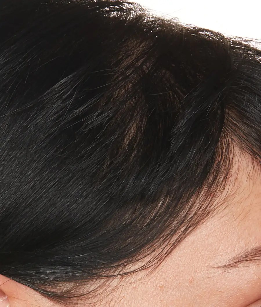 Haarwachstum nach der Anwendung des Kopfhautserums – beachten Sie alle Babyhaare